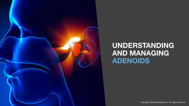 Portada de Understanding and Managing Adenoids