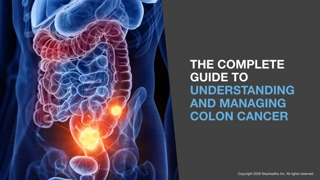 Portada de Understanding and Managing Colon Cancer