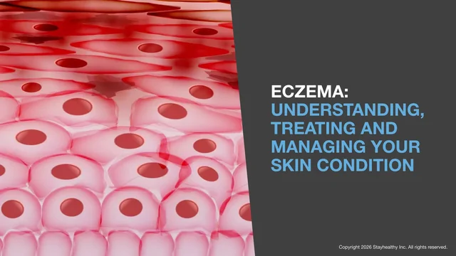 Portada de Eczema
