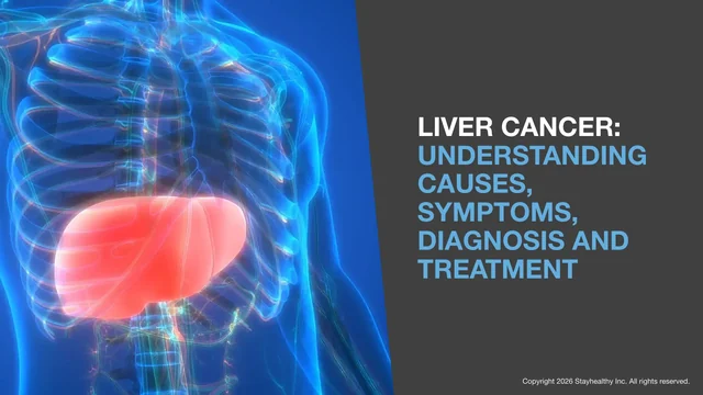 Portada de Liver Cancer