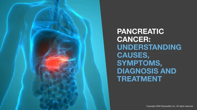 Portada de Pancreatic Cancer