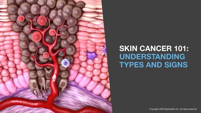 Portada de Skin Cancer 101