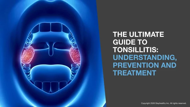 Portada de The Ultimate Guide to Tonsillitis
